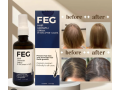 feg-hair-growth-serum-stop-hair-fall-regrow-naturally-03001819306-small-0