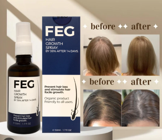 feg-hair-growth-serum-stop-hair-fall-regrow-naturally-03001819306-big-0