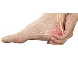 Plantar Fasciitis Specialist