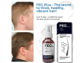 feg-hair-growth-spray-in-pakistan-reduce-hair-fall-regrow-naturally-03001819306-small-0